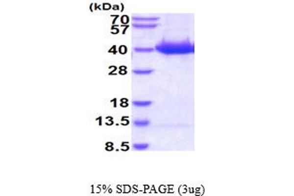 STK3 Protein (AA 1-322) (His tag)