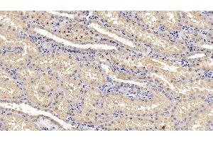 Immunohistochemistry (IHC) image for anti-Interleukin 1 Receptor Antagonist (IL1RN) (AA 26-177) antibody (ABIN7425773)