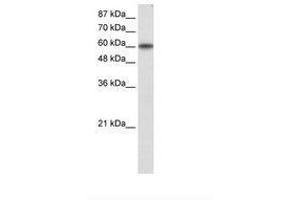 Image no. 1 for anti-Kruppel-Like Factor 11 (KLF11) (AA 61-110) antibody (ABIN203187) (KLF11 Antikörper  (AA 61-110))