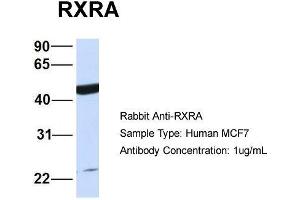 Host:  Rabbit  Target Name:  RXRA  Sample Type:  Human MCF7  Antibody Dilution:  1. (Retinoid X Receptor alpha Antikörper  (N-Term))