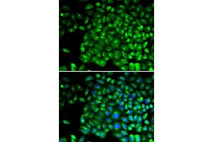 Immunofluorescence analysis of U2OS cells using TNFRSF1B antibody.
