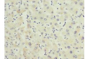 Immunohistochemistry of paraffin-embedded human liver tissue using ABIN7153138 at dilution of 1:100 (FHL3 Antikörper  (AA 1-280))