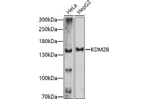 Western blot analysis of extracts of various cell lines, using KDM2B antibody (ABIN7268327) at 1:1000 dilution. (KDM2B Antikörper  (AA 600-700))