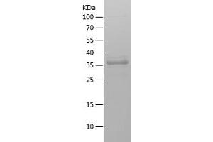 Western Blotting (WB) image for Phosphoinositide-3-Kinase, Catalytic, beta Polypeptide (PIK3CB) (AA 131-257) protein (His-IF2DI Tag) (ABIN7124426) (PIK3CB Protein (AA 131-257) (His-IF2DI Tag))