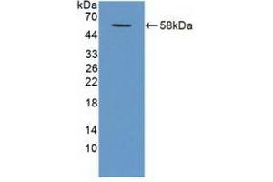 Detection of Recombinant TRAF1, Human using Polyclonal Antibody to TNF Receptor Associated Factor 1 (TRAF1) (TRAF1 Antikörper  (AA 131-381))