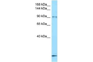 WB Suggested Anti-Fbxo11 Antibody   Titration: 1. (FBXO11 Antikörper  (C-Term))