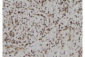 ABIN6273180 at 1/100 staining Human gastric tissue by IHC-P. (TARBP2 Antikörper  (Internal Region))