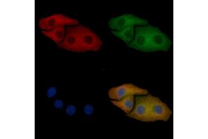 LAT2 Mouse Monoclonal Antibody staining Hela cells by IF/ICC.