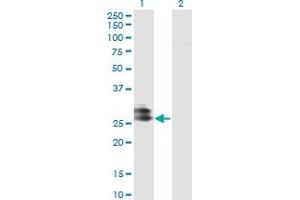 Western Blotting (WB) image for anti-Ependymin Related Protein 1 (Zebrafish) (EPDR1) (AA 38-224) antibody (ABIN565768)