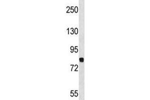Dyrk1a antibody western blot analysis in NCI-H460 lysate. (DYRK1A Antikörper  (AA 718-745))