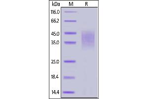SDS-PAGE (SDS) image for CD47 (CD47) (AA 19-140) (Active) protein (His tag,AVI tag,Biotin) (ABIN6950962)