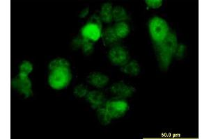 Immunofluorescence of monoclonal antibody to SOX30 on MCF-7 cell. (SOX30 Antikörper  (AA 644-753))