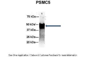 Immunoprecipitation (IP) image for anti-Proteasome (Prosome, Macropain) 26S Subunit, ATPase, 5 (PSMC5) (C-Term) antibody (ABIN2780449)