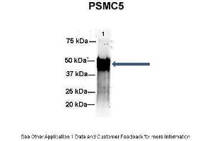 Amount and Sample Type :  500 ug mouse brain homogenate  Amount of IP Antibody :  6 ug  Primary Antibody :  PSMC5  Primary Antibody Dilution :  1:500  Secondary Antibody :  Goat anti-rabbit Alexa-Fluor 594  Secondary Antibody Dilution :  1:5000  Gene Name :  PSMC5  Submitted by :  Dr.