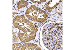 Immunohistochemistry of paraffin-embedded human kidney using TGS1 antibody. (TGS1 Antikörper)