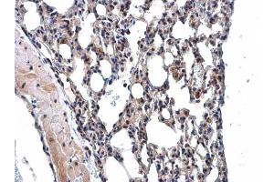 Immunohistochemistry (IHC) image for anti-Membrane Protein, Palmitoylated 3 (MAGUK P55 Subfamily Member 3) (MPP3) (Center) antibody (ABIN2856515)