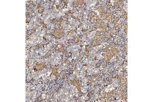 IHC analysis of EIF2AK1 using anti-EIF2AK1 antibody (ABIN7601508).