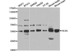 Western Blotting (WB) image for anti-Hexosaminidase A (HEXA) antibody (ABIN1876847) (Hexosaminidase A Antikörper)