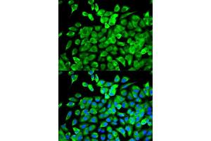 Immunofluorescence analysis of MCF-7 cells using EIF4A1 antibody. (EIF4A1 Antikörper  (AA 1-406))