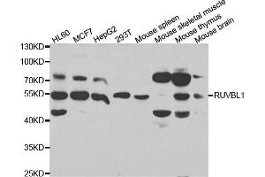 Western blot analysis of extracts of various cell lines, using RUVBL1 antibody. (RUVBL1 Antikörper)