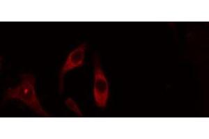 ABIN6275086 staining Hela cells by IF/ICC. (DZIP3 Antikörper  (Internal Region))