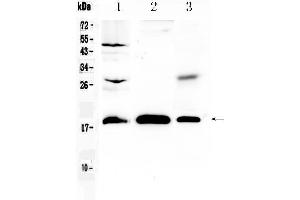Western blot analysis of TMEM240 using anti- TMEM240 antibody . (TMEM240 Antikörper  (AA 1-173))