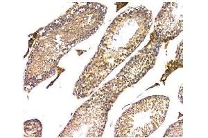 IHC analysis of WWOX using anti-WWOX antibody (ABIN6719627). (WWOX Antikörper  (AA 1-245))
