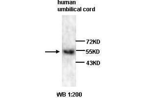 Western blot analysis of human umbilical cord lysates, using VEGF antibody. (VEGF Antikörper  (N-Term))