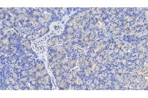Immunohistochemistry (IHC) image for anti-Caspase 1 (CASP1) (AA 120-297) antibody (ABIN7437272)