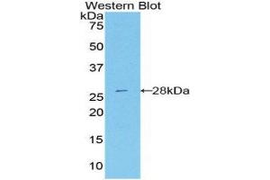 Western Blotting (WB) image for anti-DEAD (Asp-Glu-Ala-Asp) Box Polypeptide 58 (DDX58) (AA 1-211) antibody (ABIN3206479) (DDX58 Antikörper  (AA 1-211))