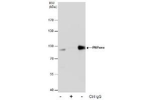 Immunoprecipitation (IP) image for anti-Polyribonucleotide Nucleotidyltransferase 1 (PNPT1) antibody (ABIN2857009)