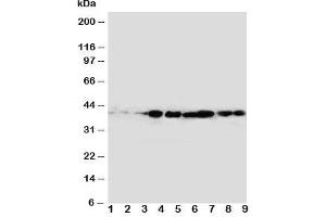 Western blot testing of CrkL antibody and rat samples 1: spleen;  2: ovary;  3: testis; and human samples 4: MM231;  5: A431;  6: MCF-7;  Lane 7;  MM231;  8: MM543;  9: Jurkat cell lysate. (CrkL Antikörper  (AA 286-303))
