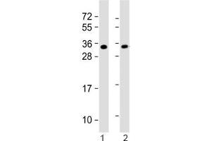 Western blot testing of 1) mouse heart and 2) rat PC-12 lysate with SLUG antibody. (SLUG Antikörper  (AA 98-129))