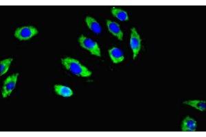 Immunofluorescent analysis of A549 cells using ABIN7167605 at dilution of 1:100 and Alexa Fluor 488-congugated AffiniPure Goat Anti-Rabbit IgG(H+L) (RGS2 Antikörper  (AA 1-241))