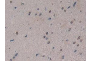 Immunohistochemistry (IHC) image for anti-Cold Inducible RNA Binding Protein (CIRBP) (AA 1-172) antibody (ABIN7442150)
