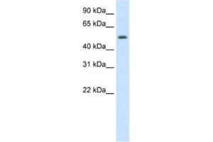 Western Blotting (WB) image for anti-Death Inducer-Obliterator 1 (DIDO1) antibody (ABIN2461922) (DIDO1 Antikörper)