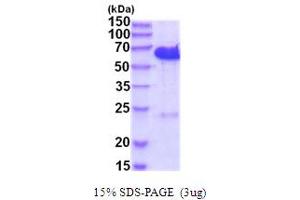 SDS-PAGE (SDS) image for CDK5 Regulatory Subunit Associated Protein 3 (CDK5RAP3) (AA 1-506) protein (His tag) (ABIN5854212) (CDK5RAP3 Protein (AA 1-506) (His tag))