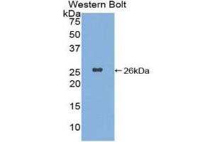Western Blotting (WB) image for anti-Xeroderma Pigmentosum, Complementation Group C (XPC) (AA 734-933) antibody (ABIN3208565) (XPC Antikörper  (AA 734-933))