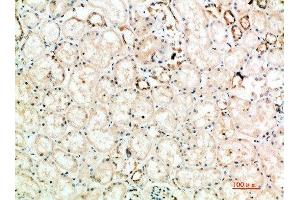 Immunohistochemical analysis of paraffin-embedded human-kidney, antibody was diluted at 1:200 (CTLA4 Antikörper  (AA 41-90))
