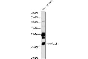 Western blot analysis of extracts of Mouse brain, using NL5 antibody (ABIN7269061) at 1:1000 dilution.
