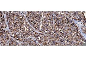 IHC analysis of CD147/Emmprin using anti-CD147/Emmprin antibody (ABIN7599998). (CD147 Antikörper  (AA 138-323))