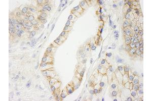 Immunohistochemistry (IHC) image for anti-C2 Calcium Dependent Domain Containing 5 (C2CD5) (AA 375-425) antibody (ABIN7448623) (C2CD5/KIAA0528 Antikörper  (AA 375-425))