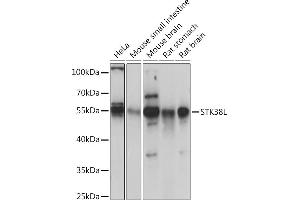 Western blot analysis of extracts of various cell lines, using STK38L Rabbit pAb (ABIN7270226) at 1:1000 dilution. (STK38L Antikörper  (AA 165-464))