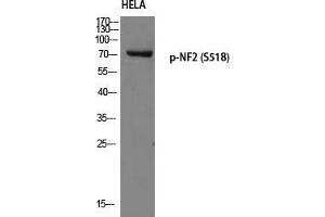 Western Blot (WB) analysis of HeLa using p-NF2 (S518) antibody.