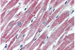 Human Heart (formalin-fixed, paraffin-embedded) stained with MAS1 antibody ABIN462250 followed by biotinylated goat anti-rabbit IgG secondary antibody ABIN481713, alkaline phosphatase-streptavidin and chromogen. (MAS1 Antikörper  (AA 187-236))
