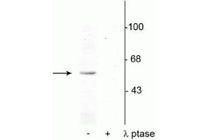 Western blot of rat brain nuclear fraction lysate showing specific immunolabeling of the ~53 kDa p53 phosphorylated at Ser392 in the first lane (-). (p53 Antikörper  (pSer392))