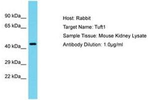 Image no. 1 for anti-Tuftelin 1 (TUFT1) (AA 201-250) antibody (ABIN6750538)
