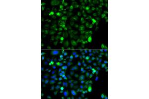 Immunofluorescence analysis of A549 cell using ZAK antibody. (ZAK Antikörper)