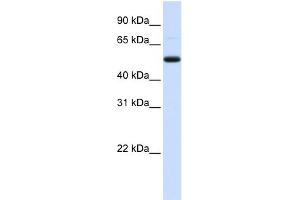 WB Suggested Anti-DCP2 Antibody Titration:  0. (DCP2 Antikörper  (Middle Region))