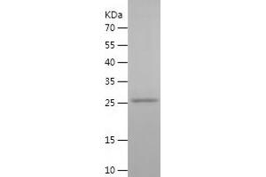 PGD Protein (AA 33-259) (His tag)